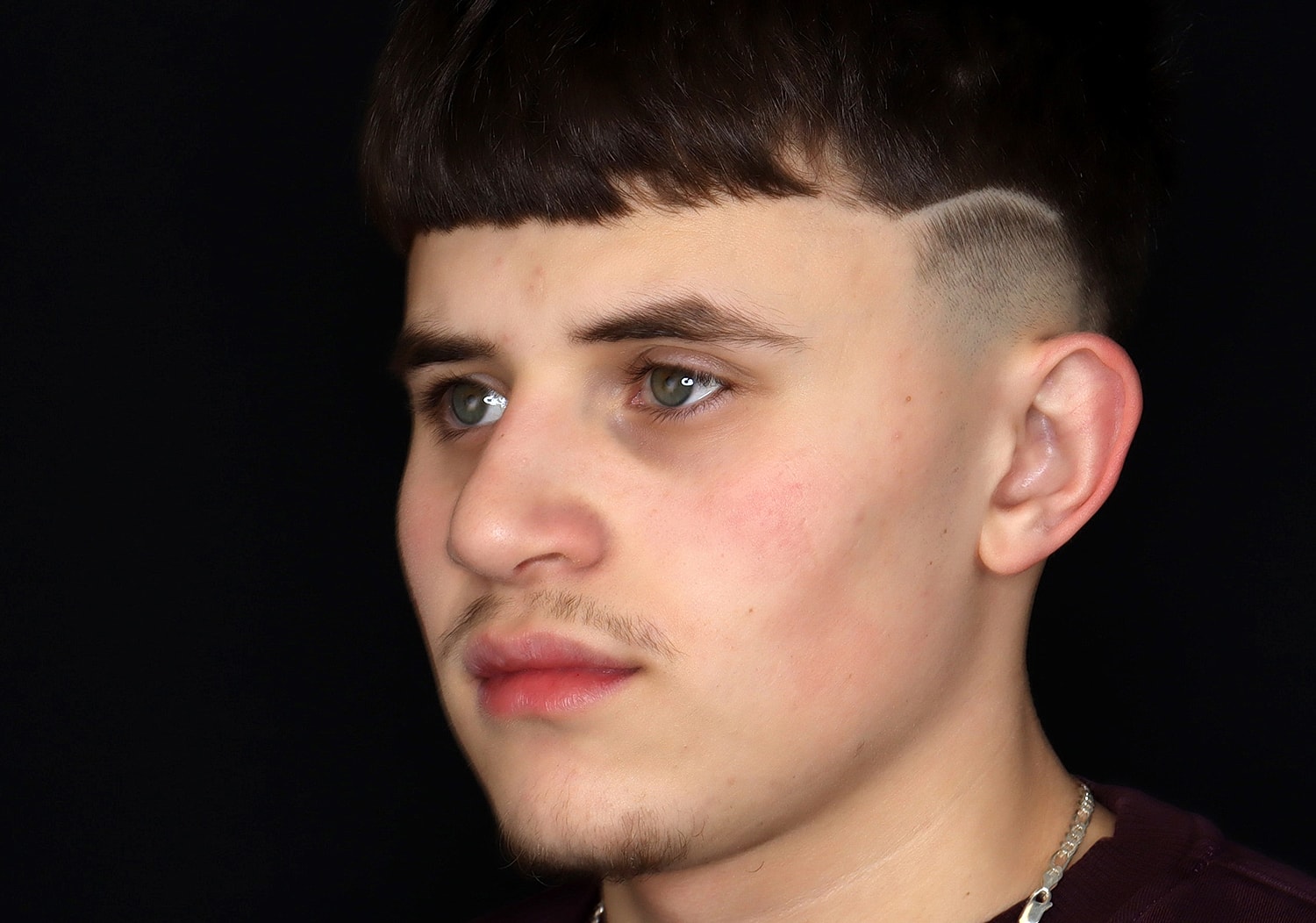 Rhinoplasty Before & After