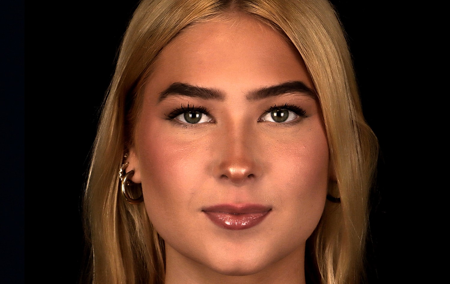 Rhinoplasty Before & After