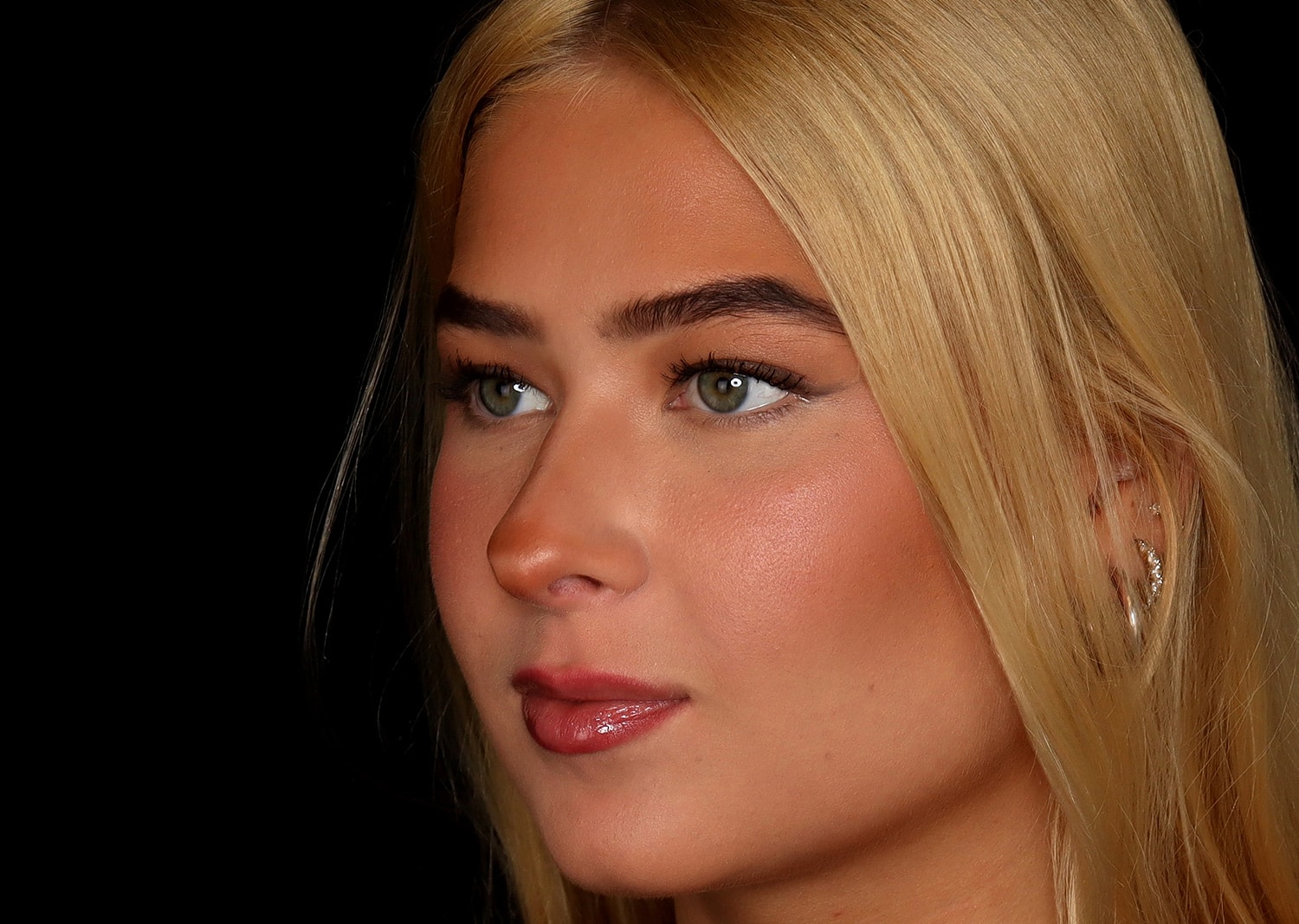 Rhinoplasty Before & After