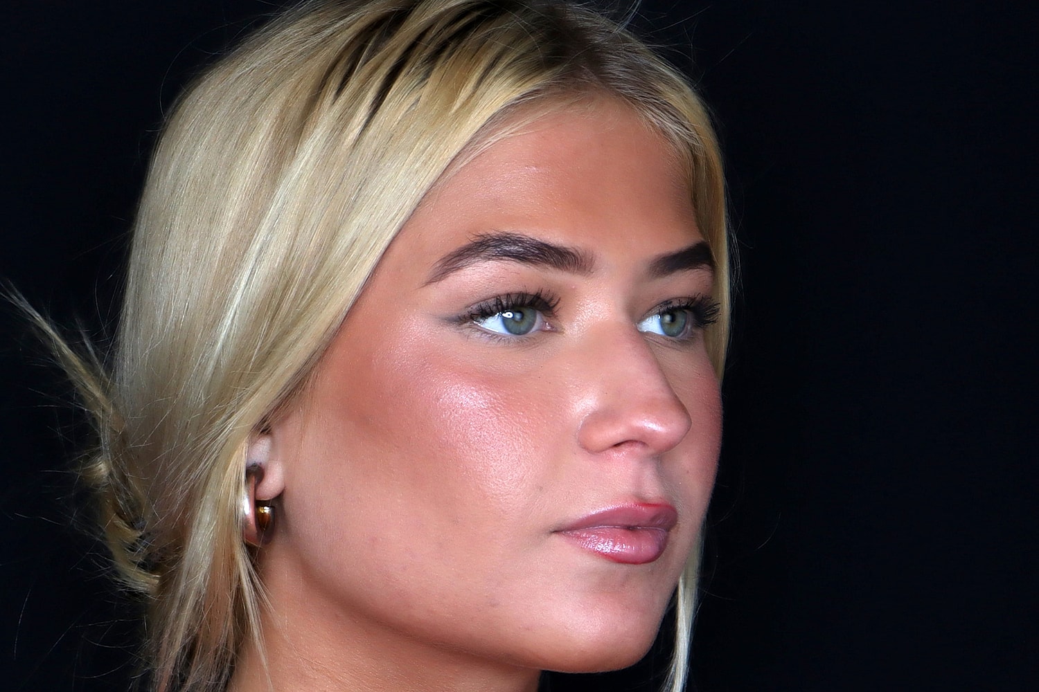 Rhinoplasty Before & After