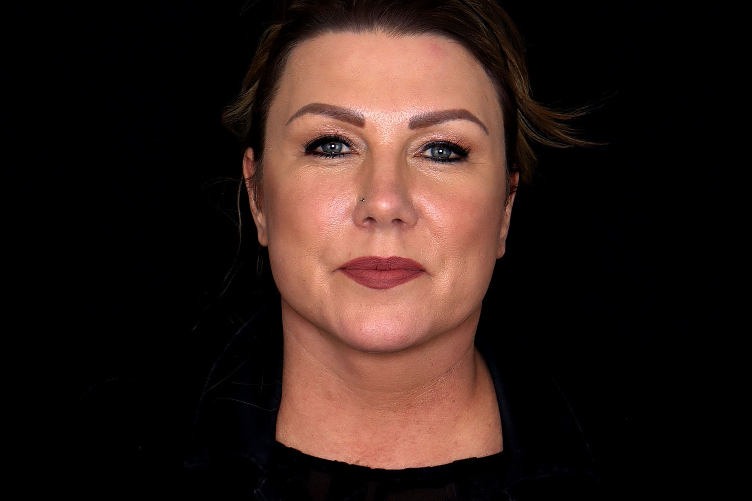 Facelift Before & After