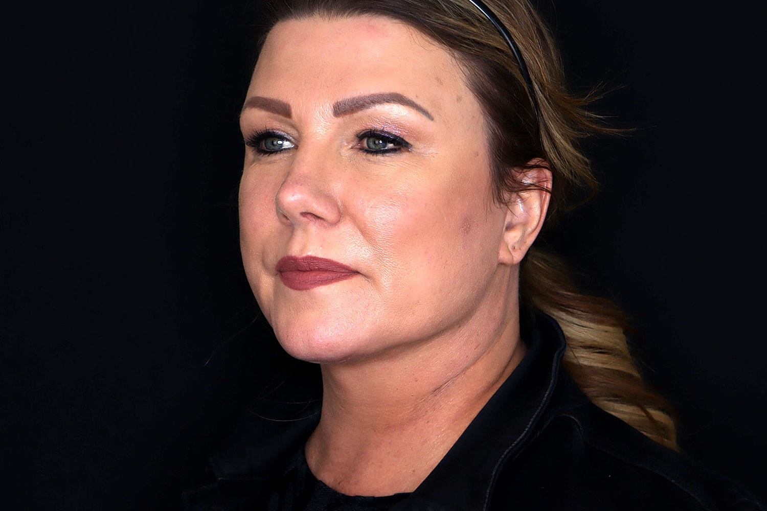 Facelift Before & After